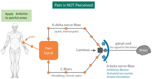 mechanism of action ArthriVio :Not Perceived Pain
