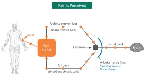 mechanism of action ArthriVio :Perceived Pain